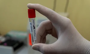 coronavirus in romania 13 ianuarie 2022 jpg