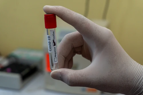 Peste 500 de persoane au fost diagnosticate cu COVID-19 în 24 de ore / Foto: Arhivă