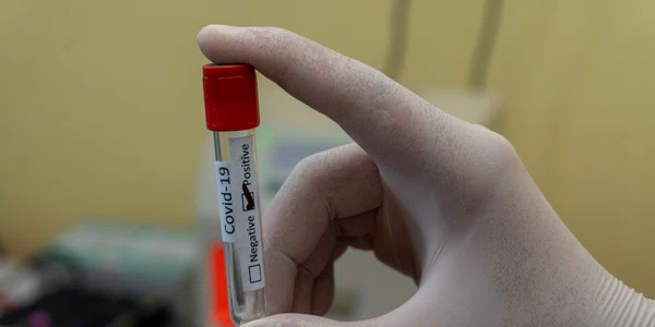 coronavirus in romania 13 ianuarie 2022 jpg