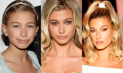 9 hailey bieber operatii estetice 3 jpg jpeg