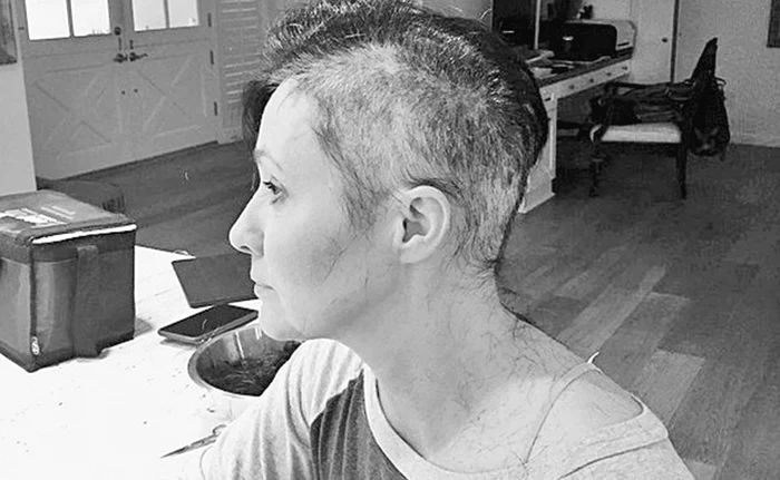 
    A renunţat la podoaba capilară pentru că îi cădea părul din cauza chimioterapiei  