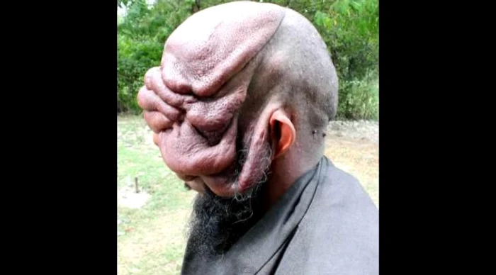 Latif nu se poate opera