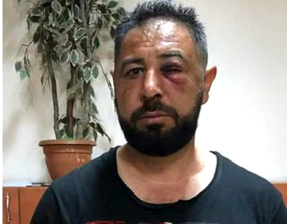 Spartacus, bătut măr de forțele de ordine, obligate să intervină