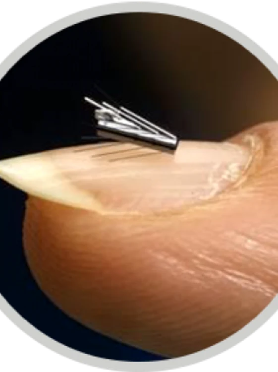 microrobot medical_foto_microbotmedical.com