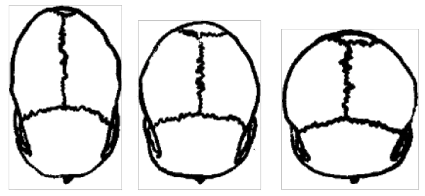 cranii jpg jpeg