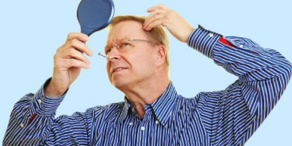 Persoanele cu psoriazis la nivelul scalpului au acum la dispoziţie un nou tratament 