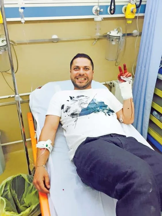 Augustin Viziru s-a tăiat cu toporul la mână în 2015, în timpul unei probe de la „Ferma Vedetelor” (PRO TV)