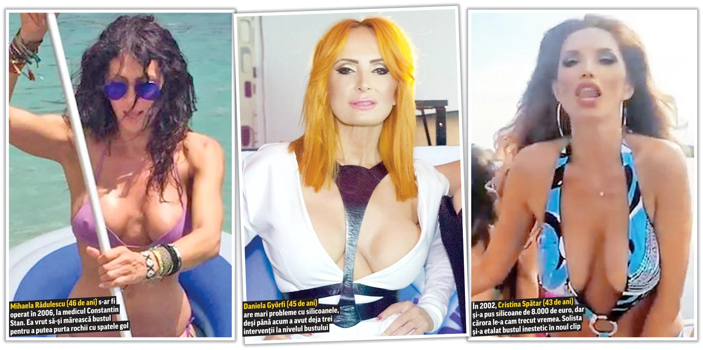 
    Divele sunt trimise  de urgenţă la cuţit,  de către esteticieni.  Bustul lor are musai nevoie de reparaţii  