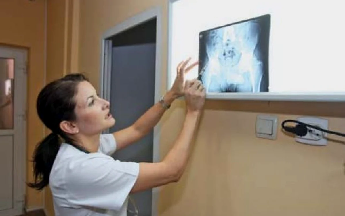 „Kilogramele în plus deteriorează articulaţiile"