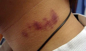 muscatura iubirii jpeg