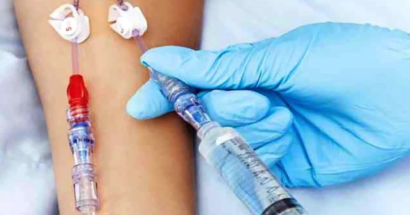 
    Perfuziile cu Vitamina C s-au dovedit eficiente în tratarea coronavirsului în China   