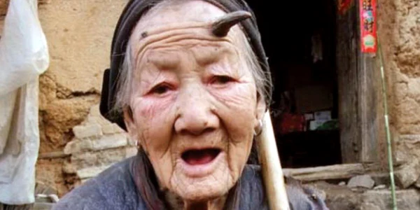 Zhang Ruifang are pe frunte un corn de 6 centimetri  
