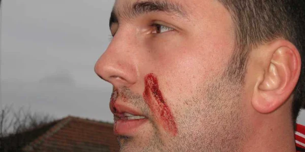 Alexandru Simionescu este hotărât să îi dea în judecată pe primarul din Tărtăşeşti şi pe şoferul acestuia