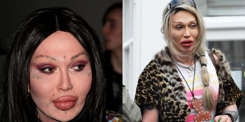 pete burns foto profimedia