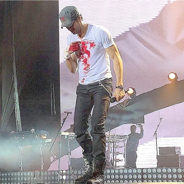 30 mai. Cântăreţul se răneşte grav la mână cu o dronă