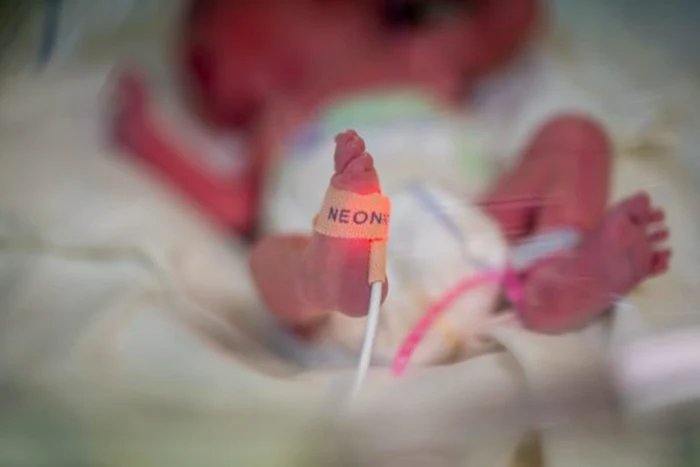 S-a născut la 22 de săptămâni și nimeni nu a crezut că va supraviețui. Foto: Monitorul de Botoșani