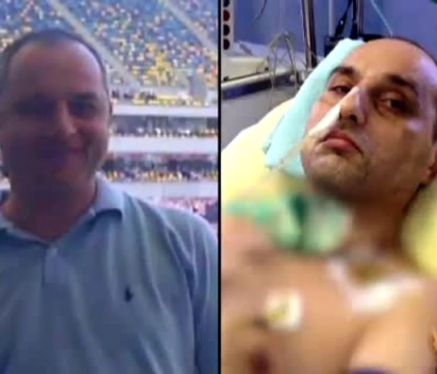 Bărbatul, care a ajuns de la 90 la 45 de kilograme, a fost îngrijit într-o clinică pentru recuperarea bolnavilor cu sechele neurologice