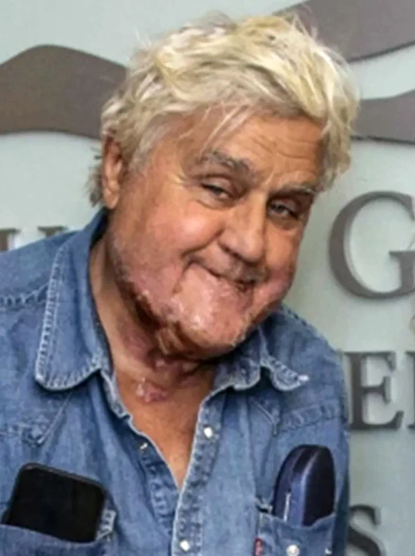 leno