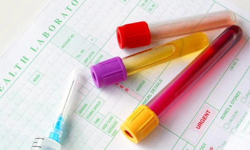 1 eprubete shutterstock 13166806 jpg jpeg