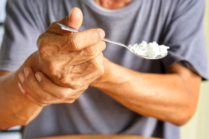 70.000 de români suferă de Parkinson- Foto Arhivă