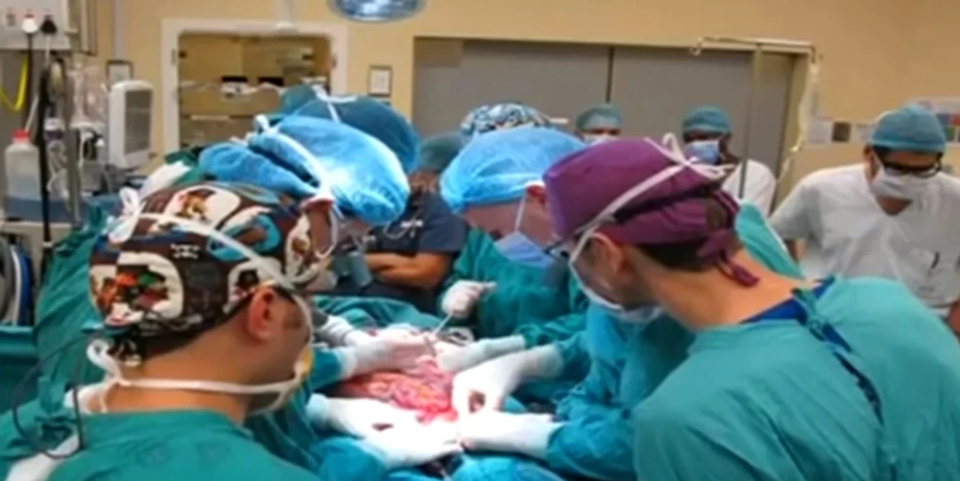 
    În martie 2015, în Africa, s-a realizat cu succes primul transplant de penis din lume. În România, operația poate fi deja efectuatăcaptură: YouTube  
