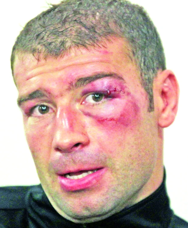 O singură dată mai pierduse înainte de limită Lucian Bute. El a fost făcut KO, pe când era la amatori, de un sportiv din Rusia, în repriza a treia