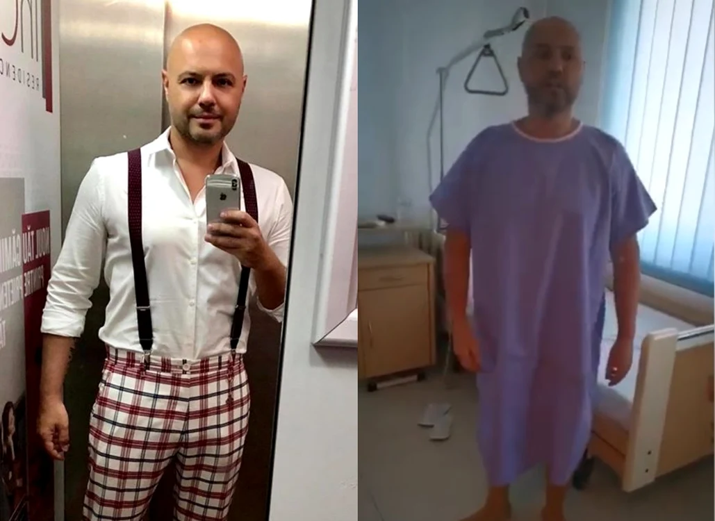 7 mihai mitoseru dupa operatie jpg jpeg