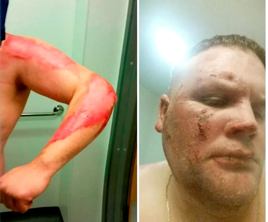 Bărbatul a reușit să scape cu viață. însă va rămâne cu cicatrici severe