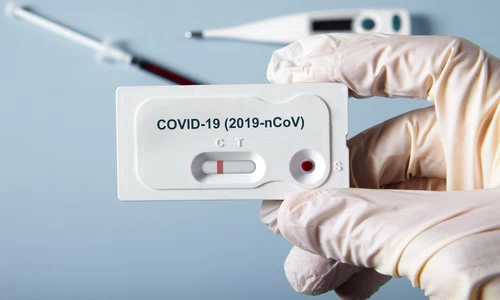 test coronavirus jpeg