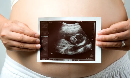 1 tipa gravida ecografie fotolia 4368870 subscription l jpg jpeg