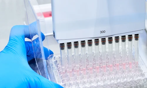 Roche test diagnostic Boala Alzheimer(1) png