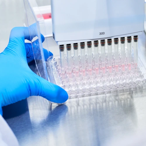 Primul test de sânge minim invaziv care ajută la excluderea bolii Alzheimer, disponibil în România
