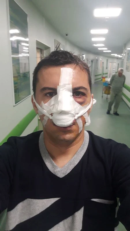 Unul dintre poliţiştii agresaţi de clanul de romi de la Călina - Prundeni din judeţul Vâlcea - de la postul de poliţie Ioneşti Foto Facebook