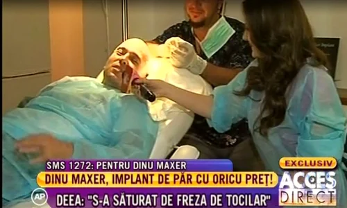 Dinu Maxer şi a făcut implant de păr jpeg