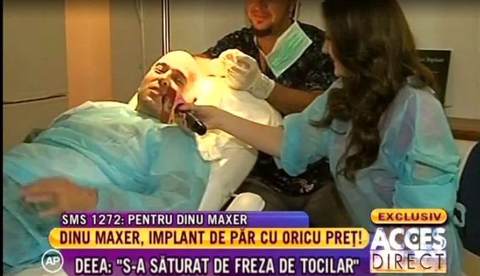 Dinu Maxer şi-a făcut implant de păr