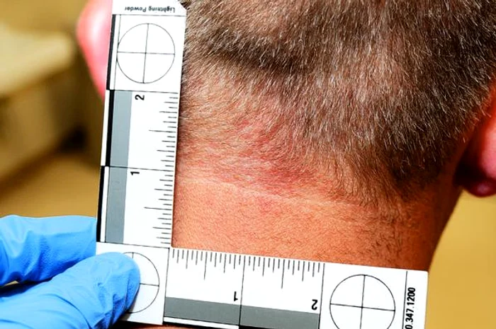 Ceafa poliţistului prezenta urme de violenţă