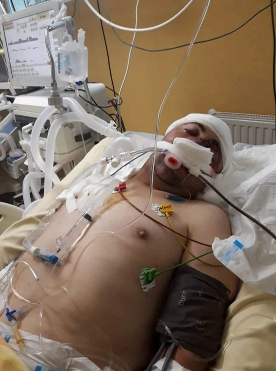 Eugen Sandu se află la secţia ATI de la Spitalul Judeţean Timişoara