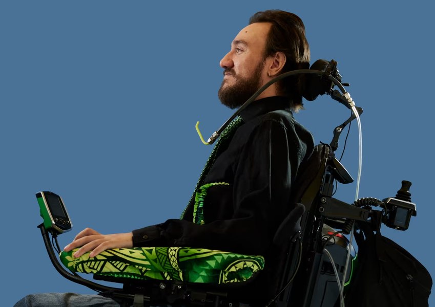 Mărturia primului pacient cu implant cerebral Neuralink: „M-a dat pe spate”