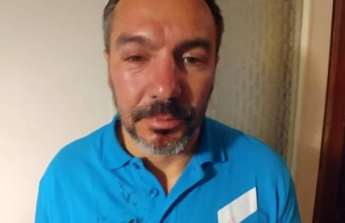 presedintele usr mehedinti bogdan chiriac batut de doi barbati foto facebook