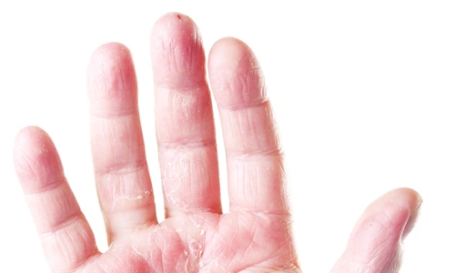 1 73638 original jpg jpeg