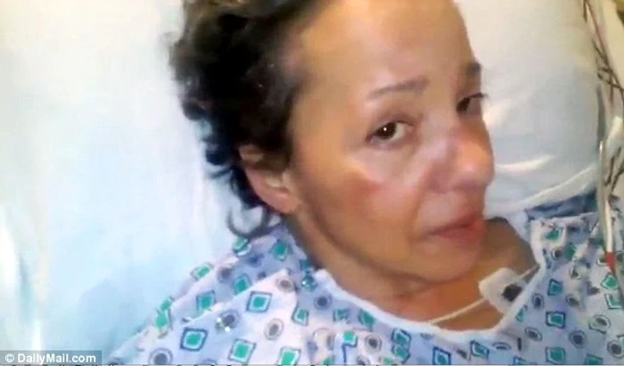 Alison Carey (54 de ani) are nevoie disperată de suport financiar pentru a-și plăti cheltuielile medicale