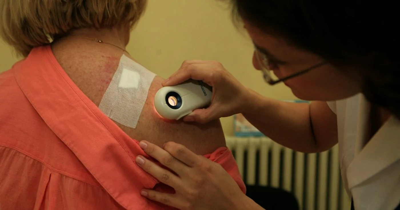 Medicul dermatolog face o consultaţie unei paciente pentru depistarea cancerului de piele