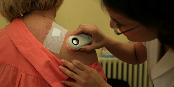 Medicul dermatolog face o consultaţie unei paciente pentru depistarea cancerului de piele