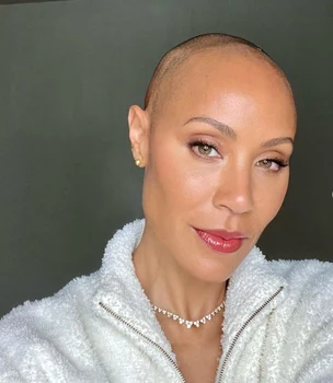 Jada Pinkett Smith suferă de alopecie