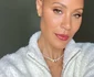 Jada Pinkett Smith suferă de alopecie