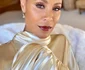 Jada Pinkett Smith suferă de alopecie