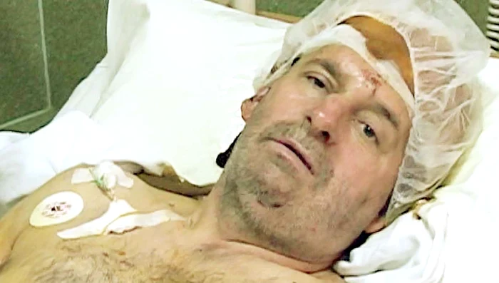 
    Victima a stat două săptămâni în spital  