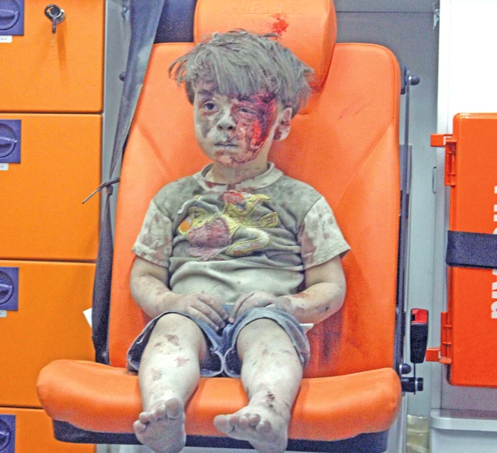 Micuţul Omran (5 ani) a fost scos de sub dărâmături plin de sânge şi moloz