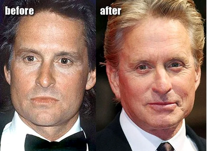 Michael Douglas