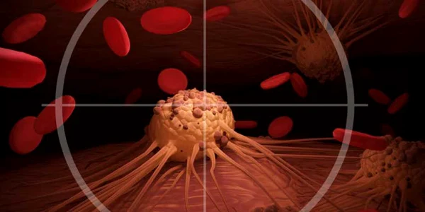 Cancer - celule canceroase FOTO 123 RF 